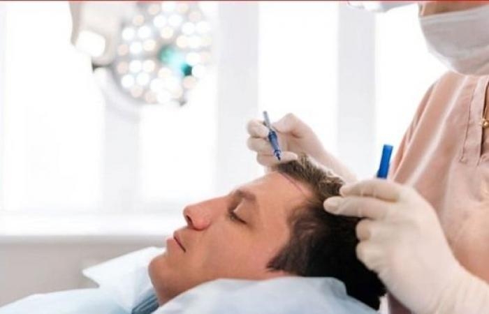 سياسة : Best Hair Transplant in Turkey with Capilclinic's Award-Winning Experts
