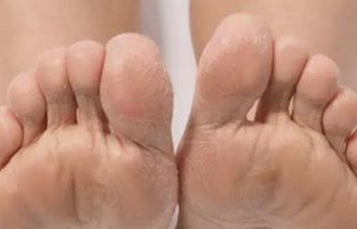 صحة وطب : إصابة رجل بعدوى رئوية بسبب عادة شم الشرابات.. أستاذ صدر يعلق