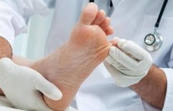 صحة وطب : دراسة.. فطريات الجلد تساعد فى مكافحة البكتيريا المقاومة للمضادات الحيوية