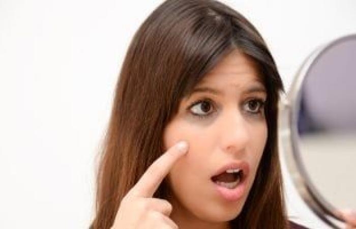 صحة وطب : علامات على الوجه تشير إلى ارتفاع مستويات الكوليسترول في الدم