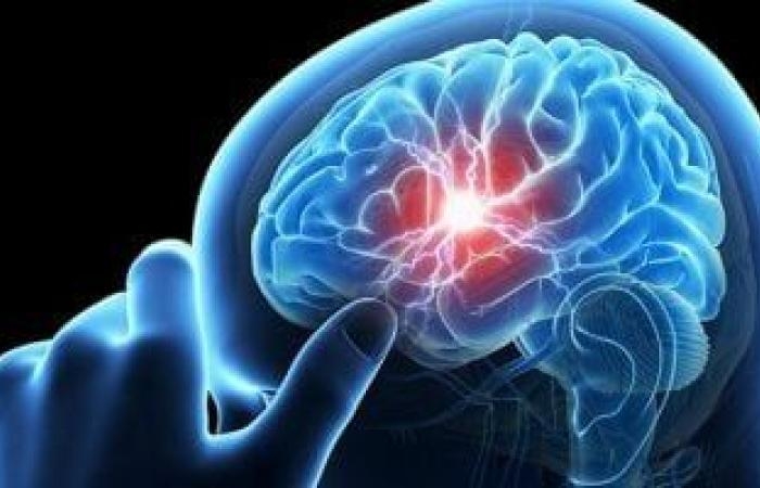 صحة وطب : الدقيقة تحدث فرقا.. علامات مبكرة لجلطة المخ تلزم اللجوء للطبيب فورا