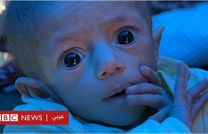 أخبار العالم : الرضيعة سوار: رحلة معاناة توثّق الجوع والحصار في غزة