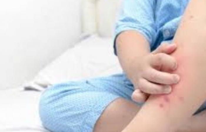 أخبار مصر : مش هتتوقعه.. طعام يخفف آلام الحمل والحساسية ومشاكل الهضم