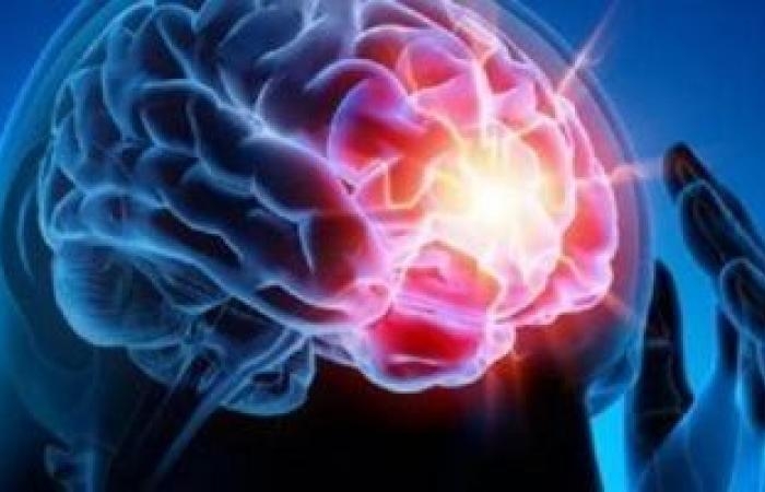 صحة وطب : احذر.. 6 عوامل تسبب إصابتك بسكتة دماغية صغيرة