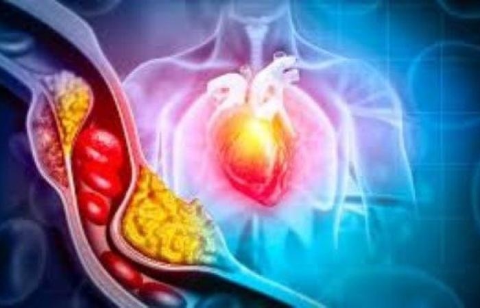 أخبار مصر : بدون أدوية.. 5 أطعمة تخفّض الكوليسترول الضار وتحمي القلب