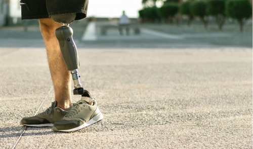 Dubai Police Gift Inmate Dh87,000 Prosthetic Limb, Ending Years of Pain