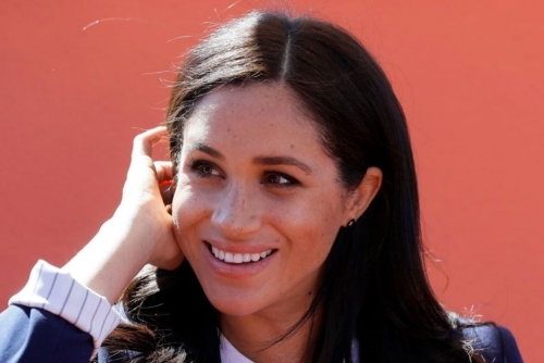 Meghan claims freckles cost her acting work