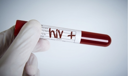 Philippines warns of health emergency as HIV cases soar