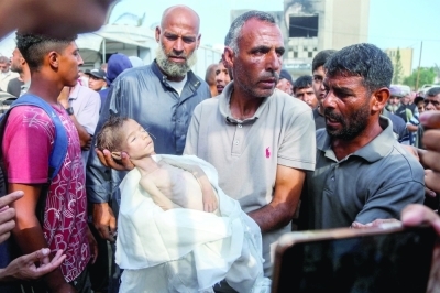 رضّع غزة «يموتون جوعا».. والأونروا: إسرائيل تجوّع مليون طفل