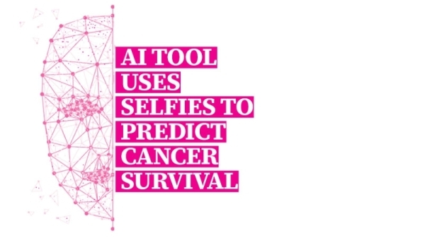 AI tool uses selfies to predict cancer survival