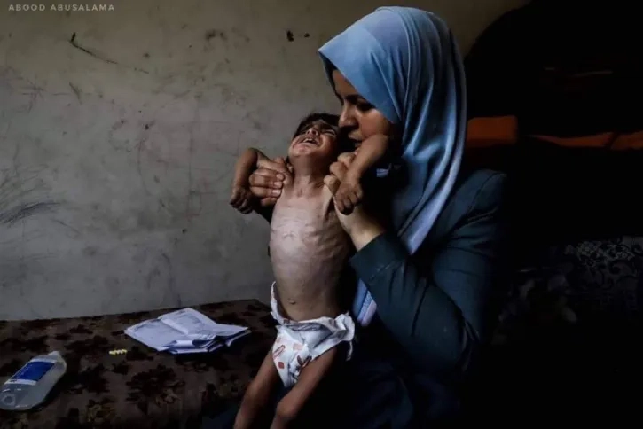 المفوضية الأوروبية: استخدام المساعدات كأداة حرب محظور بموجب القانون الدولي الإنساني