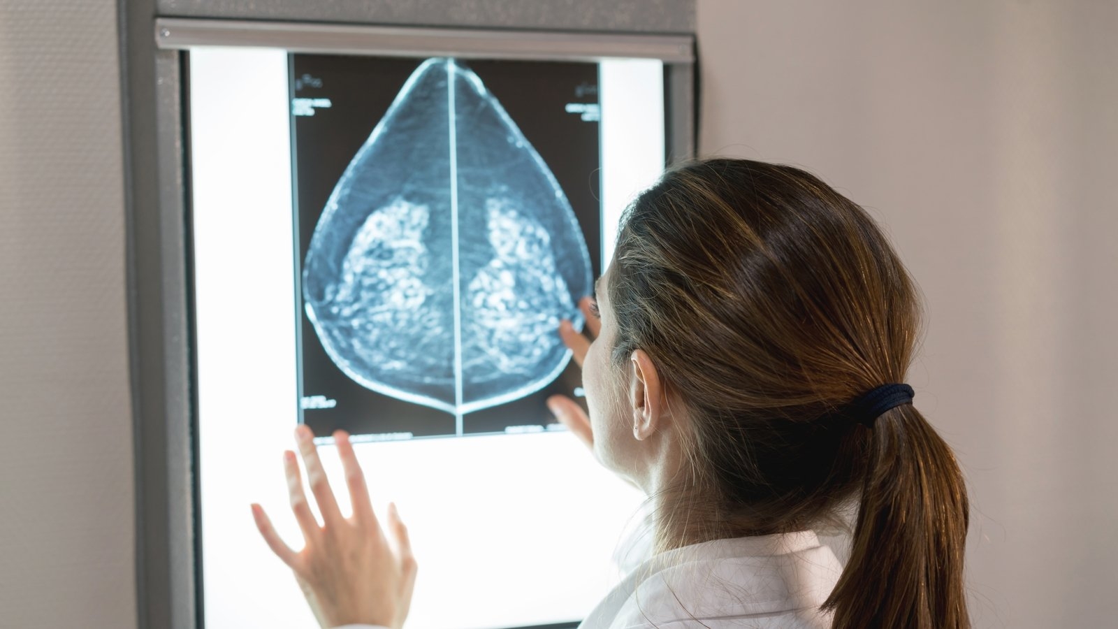 €4m for Galway university to improve breast cancer research