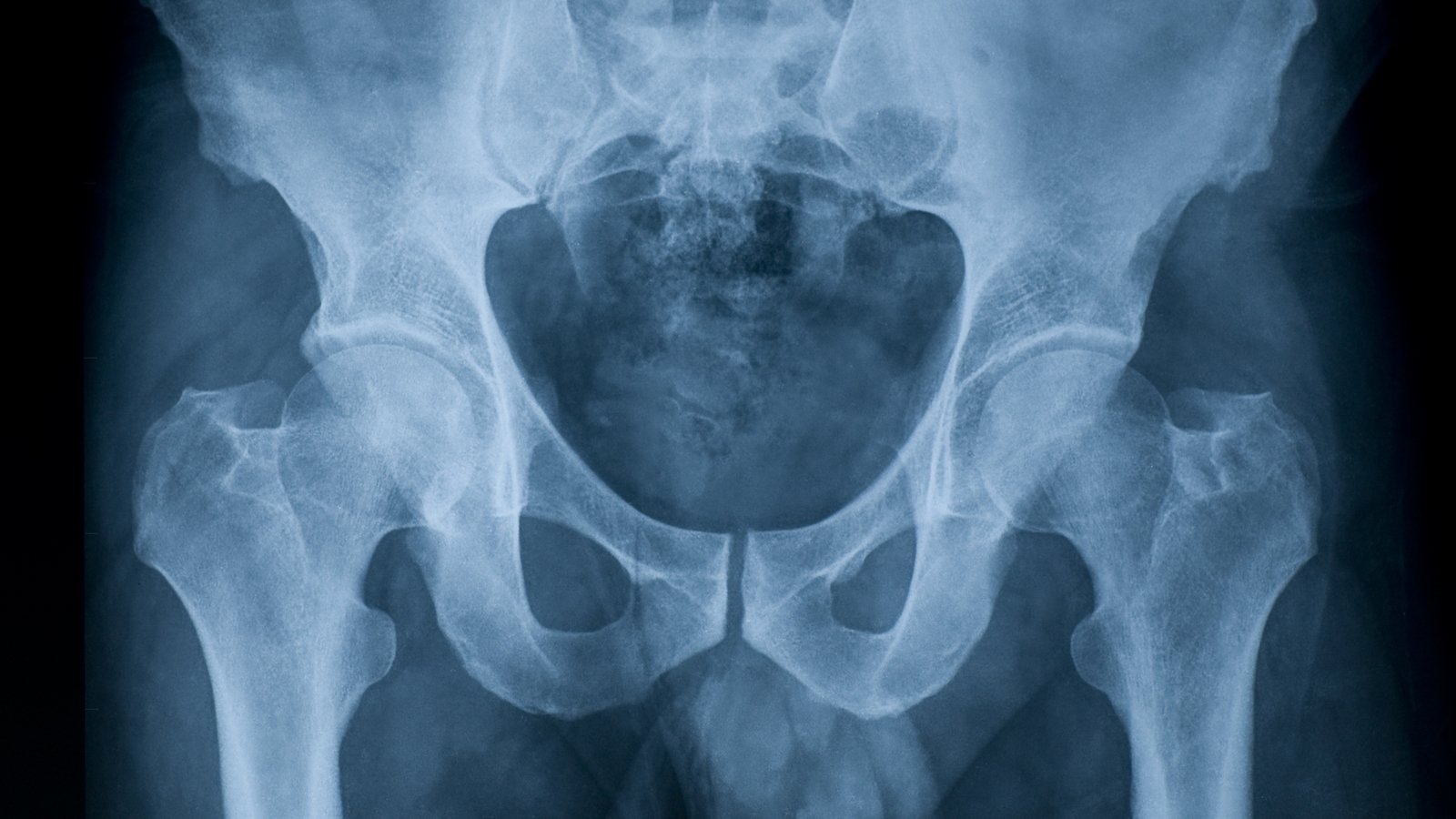 Questions from hip audit to take many months to answer