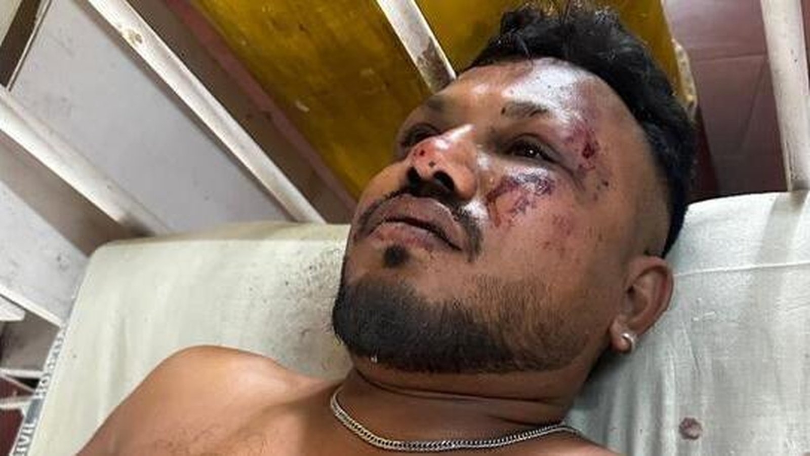 British man survives fatal India plane crash