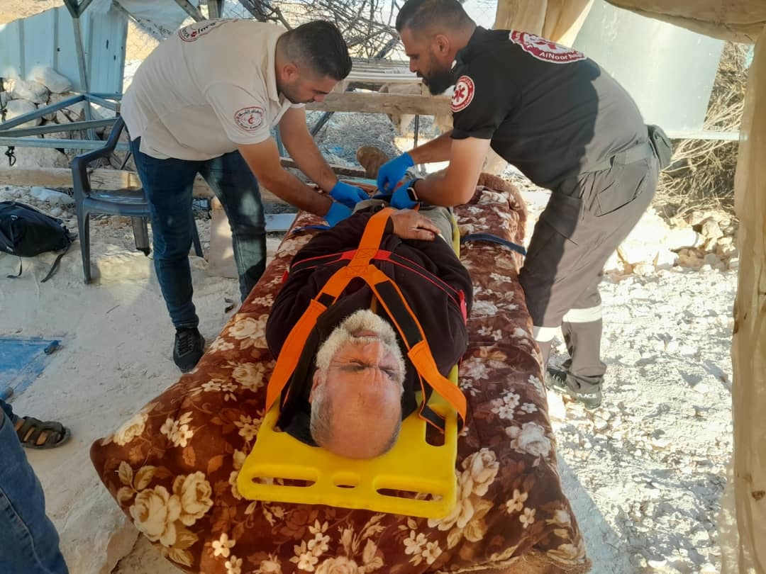 Palestinian Injured in Attack by Settlers on Residents of Khirbet Umm Nir in Hebron