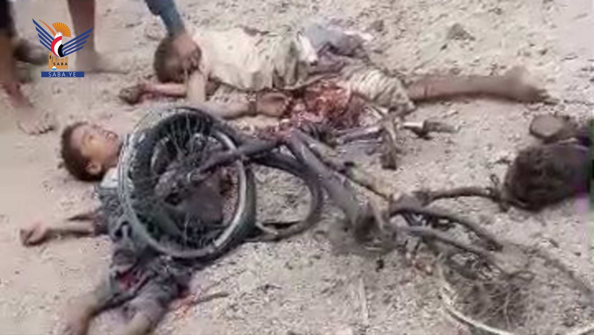 Taiz: Five children martyred by Islah Party artillery shell in al-Hashmah area