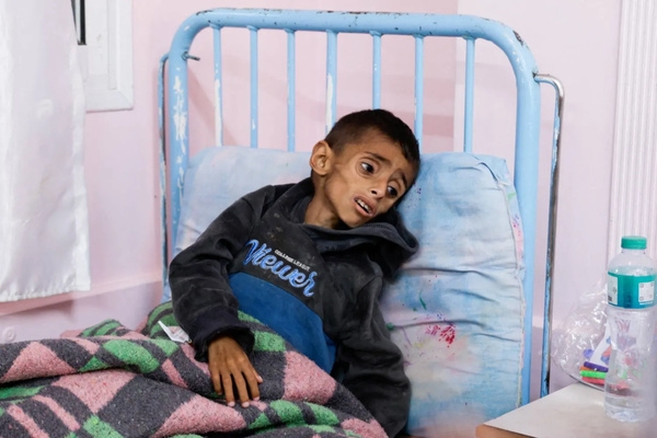 UNICEF warns of alarming rise in acute malnutrition among Gaza's Children