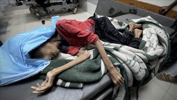 Death toll from famine, malnutrition in Gaza rises to 235, including 6 children