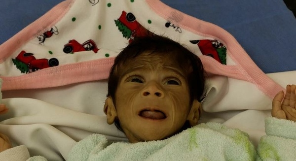 Gaza Ministry: Famine death toll rises to 169, 7 died in last 24 hours