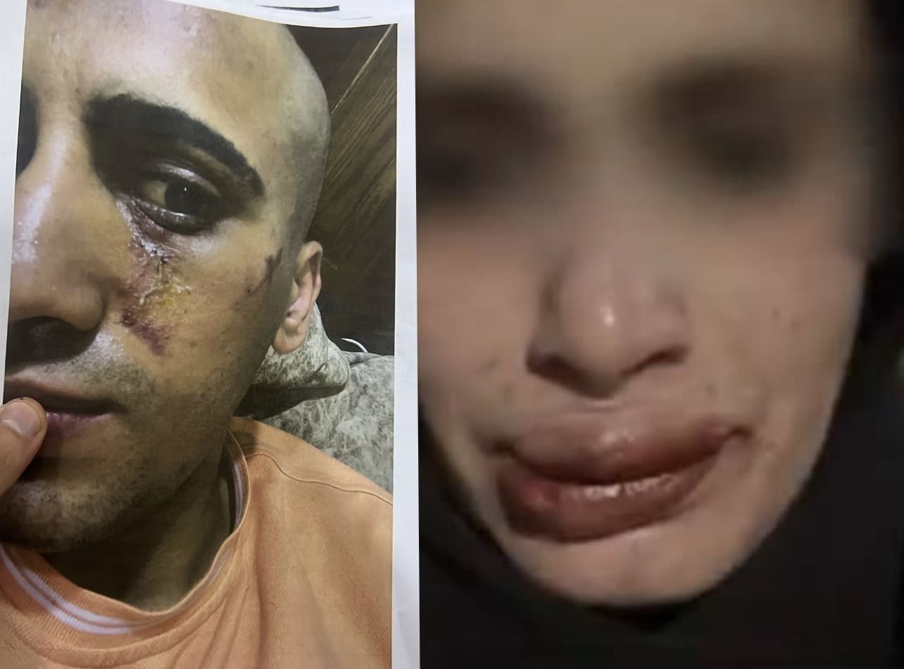 أحمد يخرج عن صمته ويكشف تفاصيل تعذيبه هو وشقيقته على يد والده وإخوته .. فيديو وصور