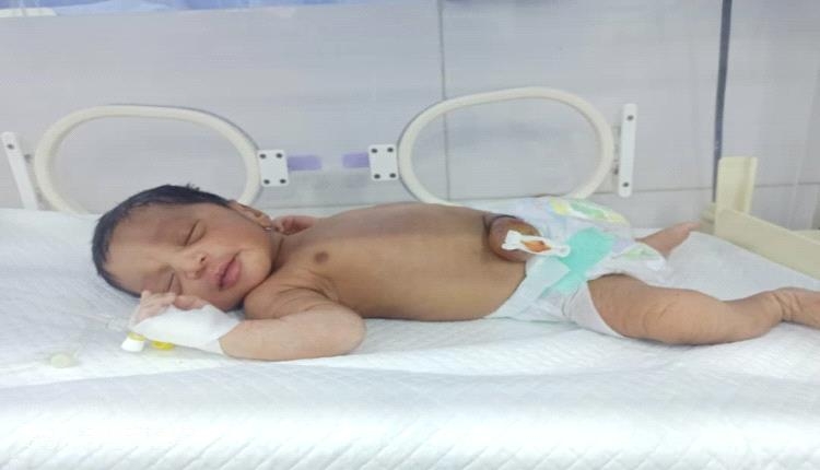 فاعل خير يتكفل بإجراء عملية جراحية للطفل 'محمد التويم' بأبين