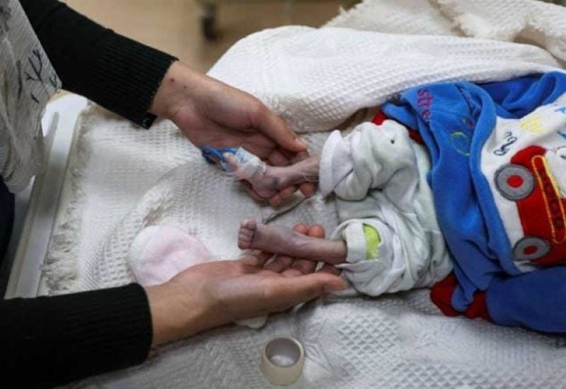 مجمع ناصر الطبي: الأطباء في غزة محبطون من الأوضاع المتردية للأطفال