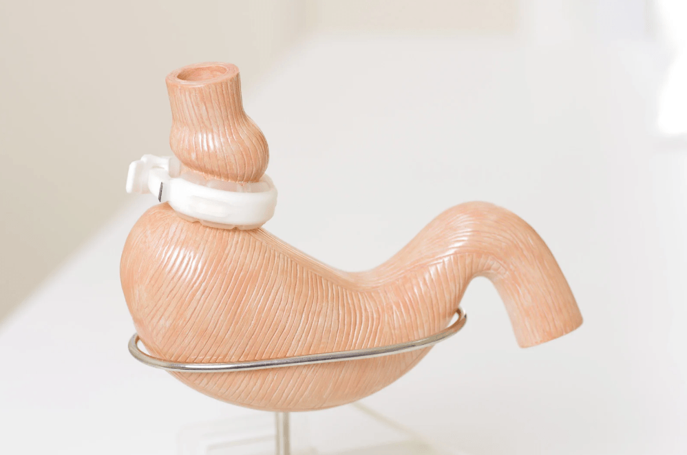HRPB bariatric clinic offers hope to patients battling obesity