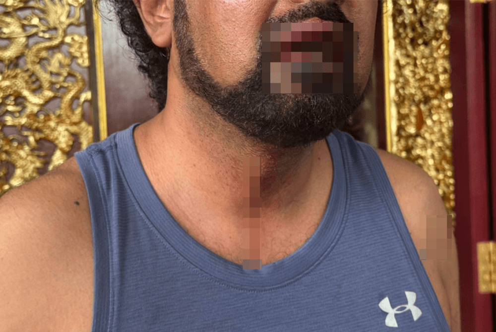'Is there something suspicious?' MCA Youth asks after attack on key trial witness
