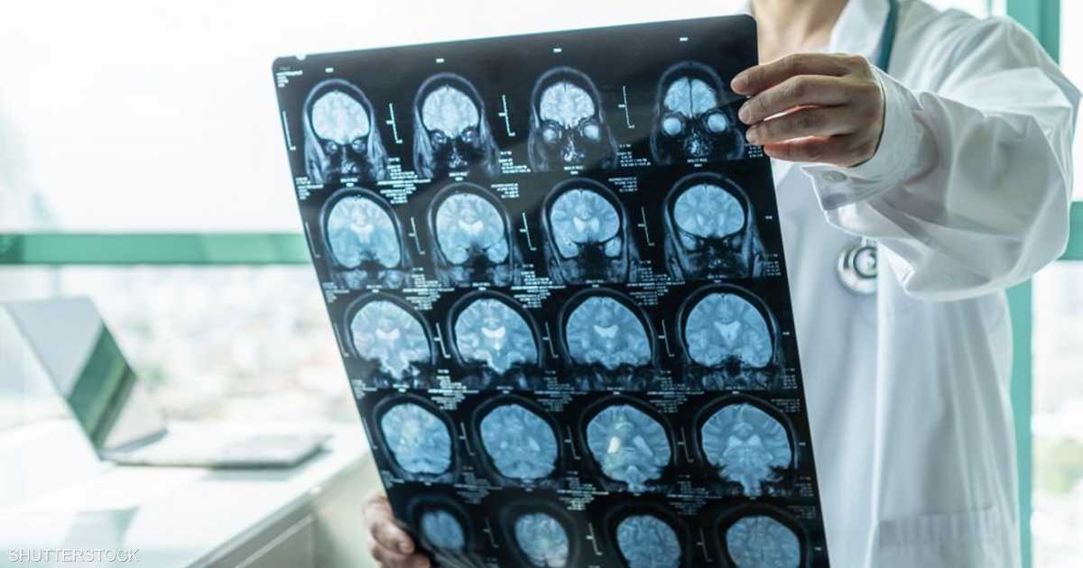 وفاة 3 أشقاء في المنيا بمصر بعد إصابتهم بالتهاب السحايا