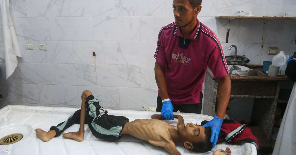 "الشلل الرخو الحاد" يصيب العشرات في غزة.. ما هو؟