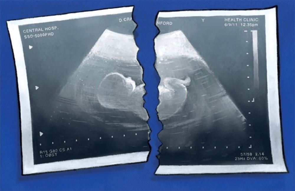 The abortion debate is as old as time