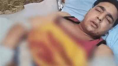 أنثى وليس ذكر.. ماذا قالت اللجنة المنتدبة في واقعة إلتهام نمر لذراع عامل بسيرك طنطا