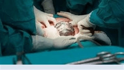 إنقاذ طفل به عيب خلقي بالرئة يبلغ من العمر 3 أشهر في مستشفى قنا