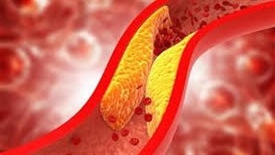 فواكه تُنقذ القلب من الكولسترول.. 9 أنواع طبيعية بخواص دوائية مذهلة