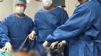 إنجاز طبي غير مسبوق بمجمع الإسماعيلية الطبي: استئصال ورم بالبنكرياس لسيدة مسنة باستخدام المنظار الجراحي