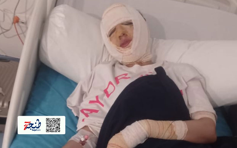 هيركوليس بارك يفتتح أبوابه بعرض يدمر مستقبل فتاة (فيديو)