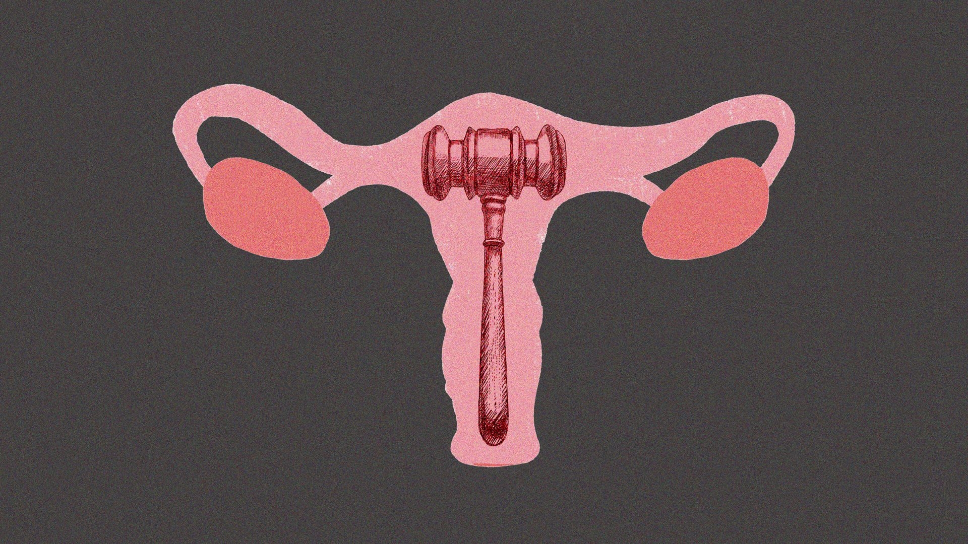 It's time to decriminalise abortion