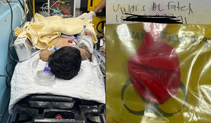 Birthday Party Turns Critical: Deflated Balloon Nearly Claims Child's Life