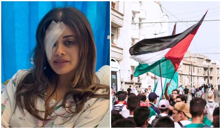 Former AG's Daughter 'May Lose An Eye' After Pro-Palestine Protest Incident