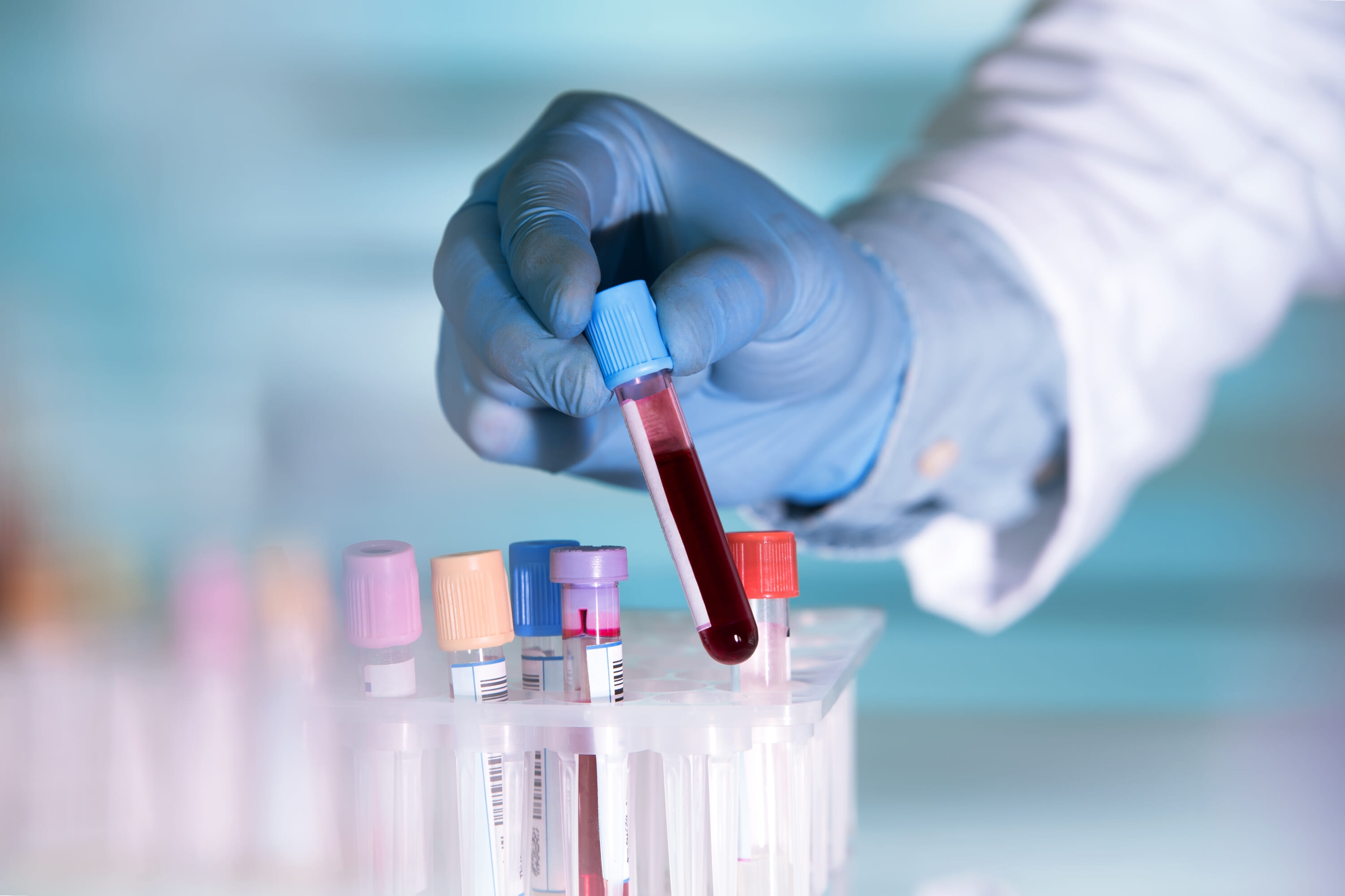 Japanese Scientists Develop Artificial Blood Compatible With All Blood Types