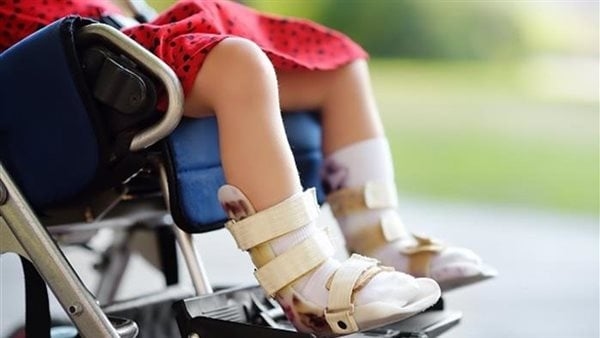 هيئة الدواء تحذر من أعراض شلل الأطفال وتوضح أهم أنواعه وأخطرها