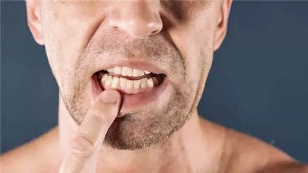 أستاذ طب الأسنان: 4 أعراض خطرة تنذر بضرورة حشو العصب