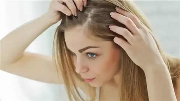 علاج التهاب فروة الرأس بالمنزل ومتى يجب زيارة الطبيب؟