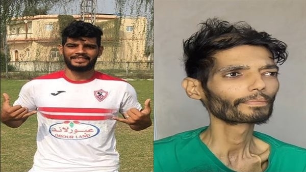 وداع مبكر لإبراهيم شيكا.. وفاة لاعب الزمالك السابق بعد صراع مرير مع المرض.. صدمة في الوسط الرياضي.. وهذا موعد صلاة الجنازة