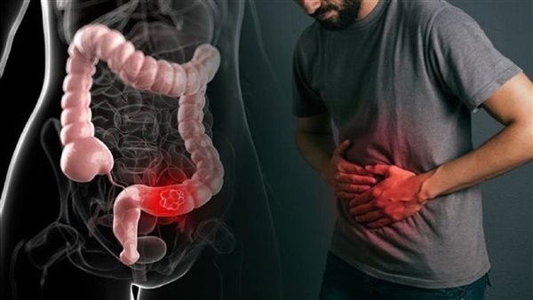 نصائح في عيد الأضحى لتجنب الإصابة بالإمساك