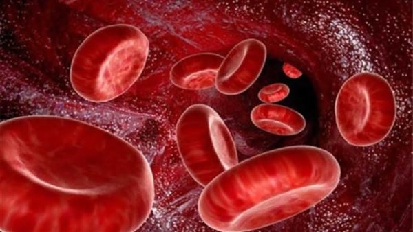 5 وصفات طبيعية تساعد في علاج أنيميا فقر الدم