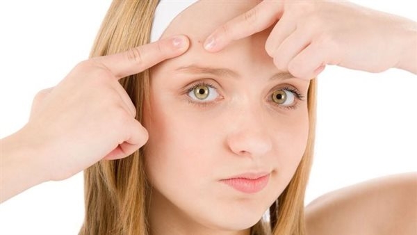 أبرزها العسل والقرفة، أفضل الوصفات الطبيعية للتخلص من حبوب الجبهة