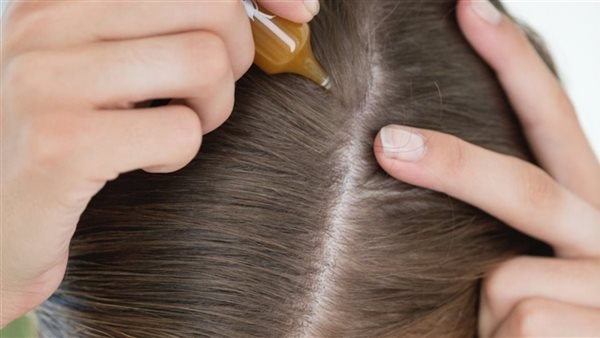 وصفات طبيعية فعالة لعلاج الشعر الخفيف واستعادة كثافته