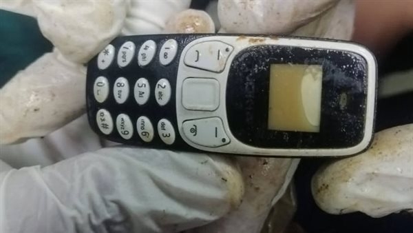 من دون جراحة، أزهر أسيوط الجامعي يستخرج "موبايل" من بطن مريض (صور)