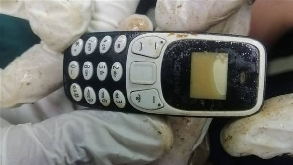ابتلعه منذ سنتين، استخراج هاتف محمول من معدة مريض بمستشفى الأزهر بأسيوط (صور)